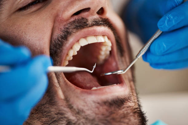 Best Emergency Treatment for Toothache in Williamsburg, PA